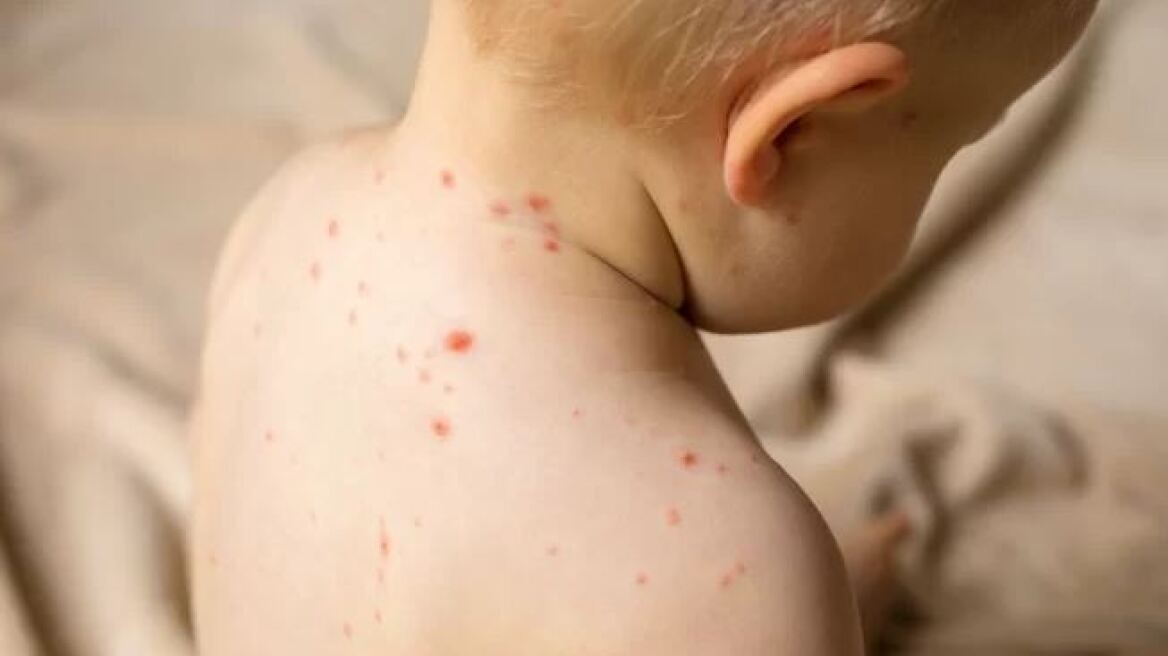 Αμερικανός κυβερνήτης πήγε τα εννέα παιδιά του σε «πάρτι ανεμοβλογιάς» για να κολλήσουν!