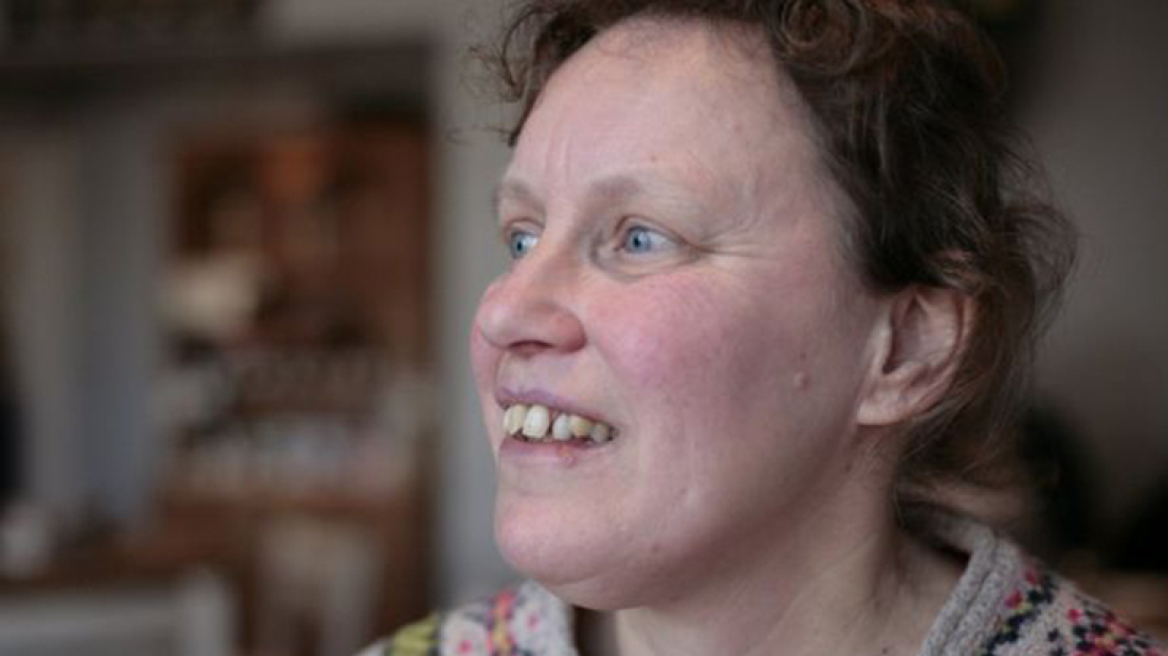 Η γυναίκα που δεν αναγνωρίζει το ίδιο της το πρόσωπο