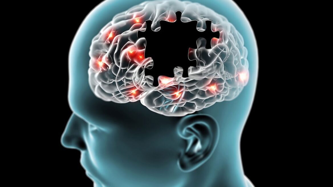 Το γονίδιο που μας σώζει από το εγκεφαλικό επεισόδιο