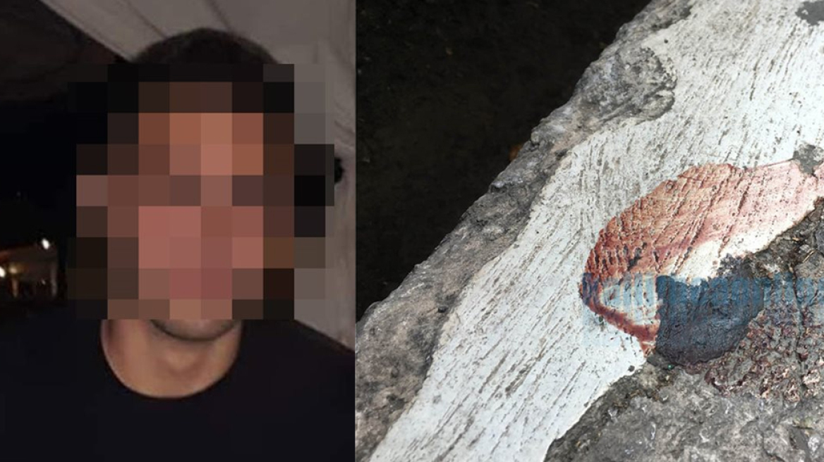 Σοκάρει ο 19χρονος που μαχαίρωσαν στην Καλλιθέα: «Η καρδιά μου είχε μια τεράστια τρύπα...»