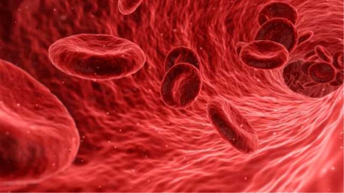 Εγκρίθηκε γονιδιακή θεραπεία για την αντιμετώπιση της Μεσογειακής Αναιμίας