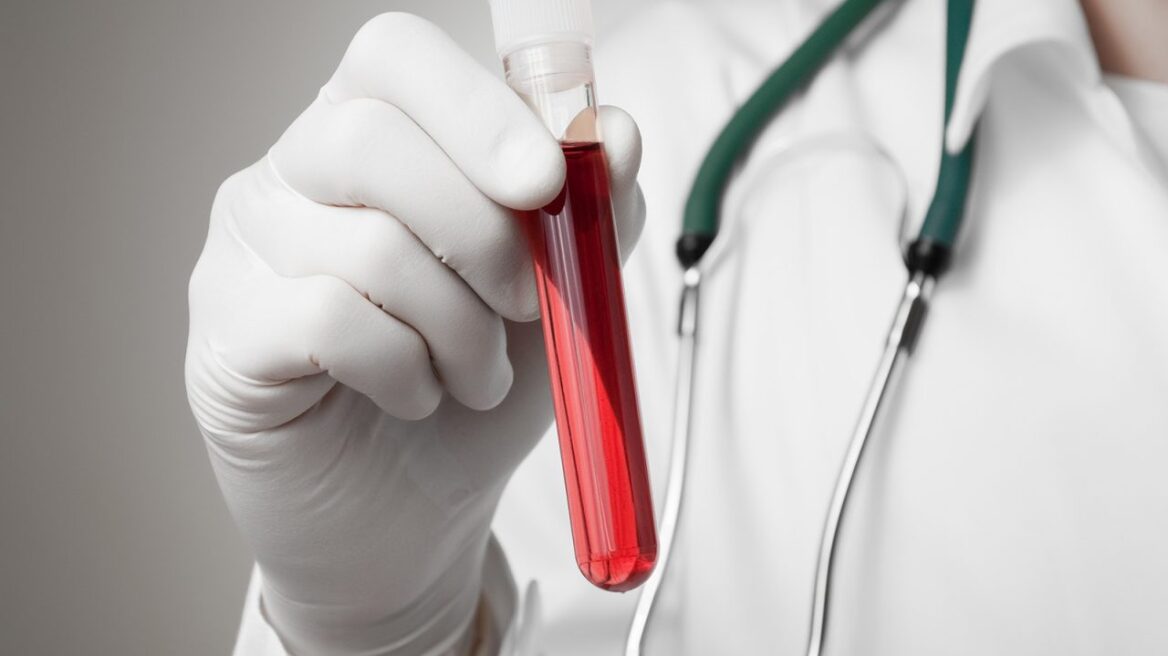 AIDS: Σχεδόν 770.000 οι νεκροί από την νόσο το 2018