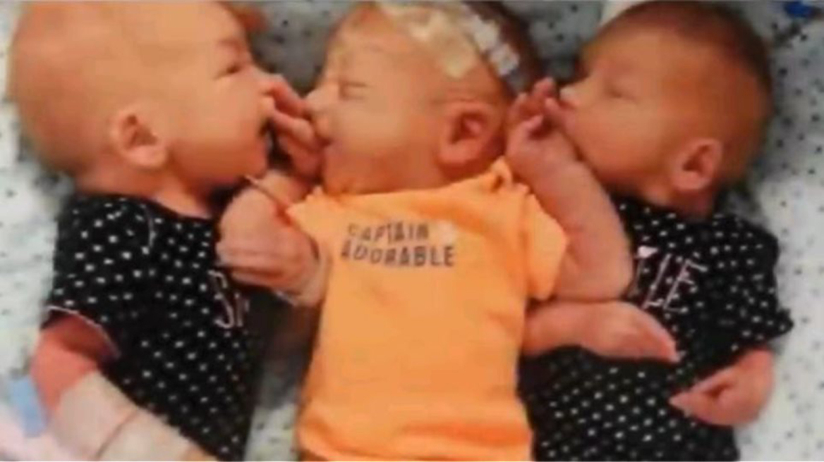 Ο κολικός νεφρού... που της «έφερε» τρίδυμα