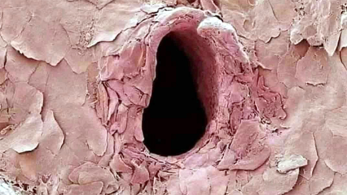 Κουίζ: Τι αναπαριστά αυτή η εικόνα