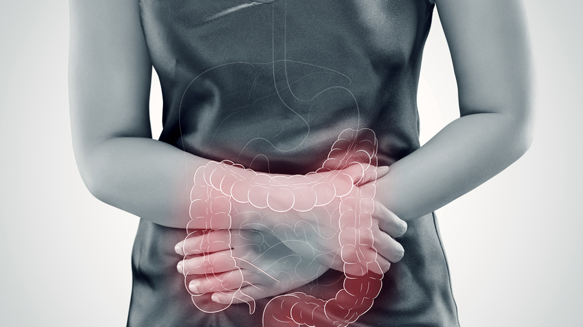 Νόσος Crohn: Η πρωτεΐνη που οδηγεί σε νέα θεραπεία