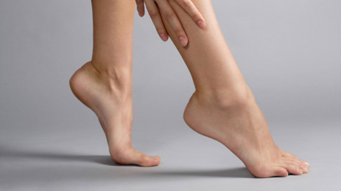 Φλεβική ανεπάρκεια και κιρσοί: Οι ασκήσεις που βοηθούν και τα σπορ που βλάπτουν