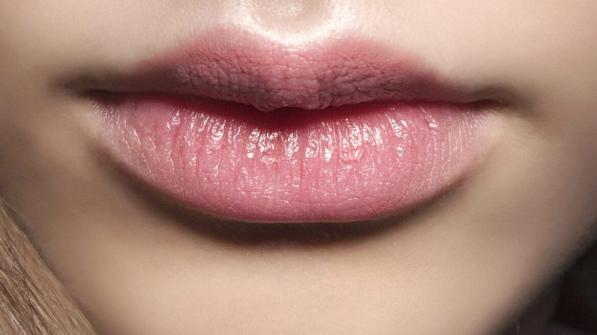 Ξεράθηκαν τα χείλη σας; Δείτε τι να κάνετε 