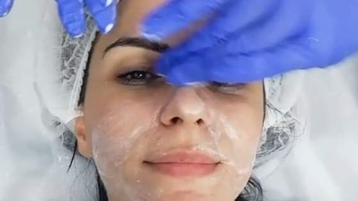 Beauty Challenge #1: Δοκίμασα το DermaInfusion, έναν εξειδικευμένο καθαρισμό δέρματος