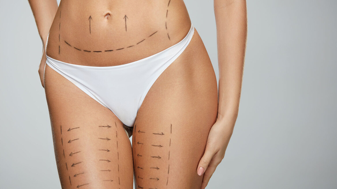 Λιπογλυπτική: Η τεχνική που σμιλεύει πρόσωπο και σώμα