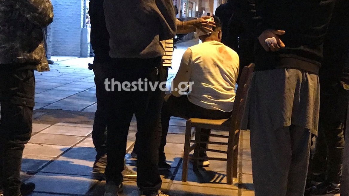 Θεσσαλονίκη: Αιματηρό επεισόδιο μεταξύ αλλοδαπών - Ένας τραυματίας