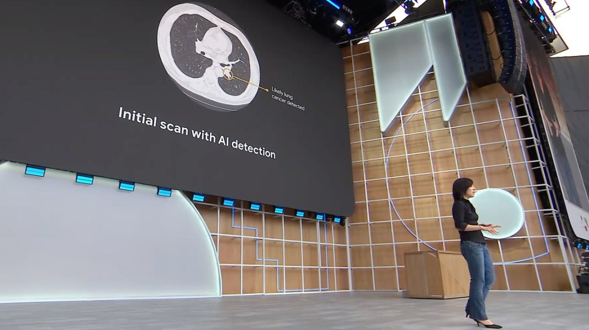 Google: Νέο σύστημα τεχνητής νοημοσύνης ανιχνεύει με ακρίβεια παθήσεις στους πνεύμονες