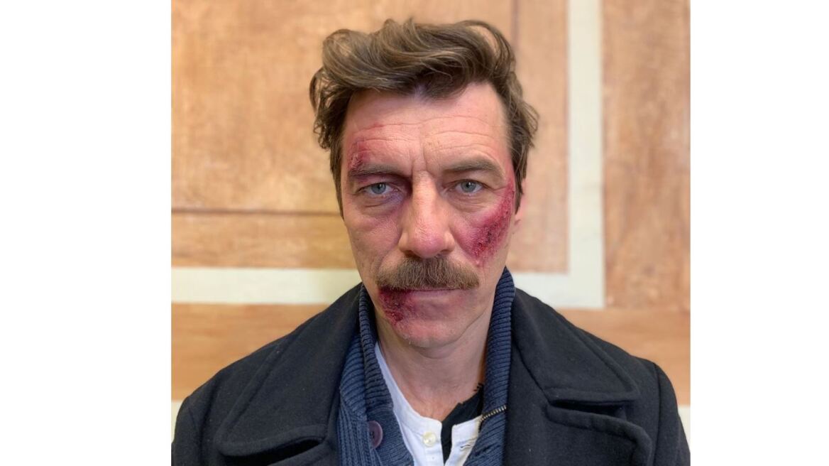 Άγριες Μέλισσες: Ποιος έκανε τόπι στο ξύλο τον Γιάννη Στάνκογλου;