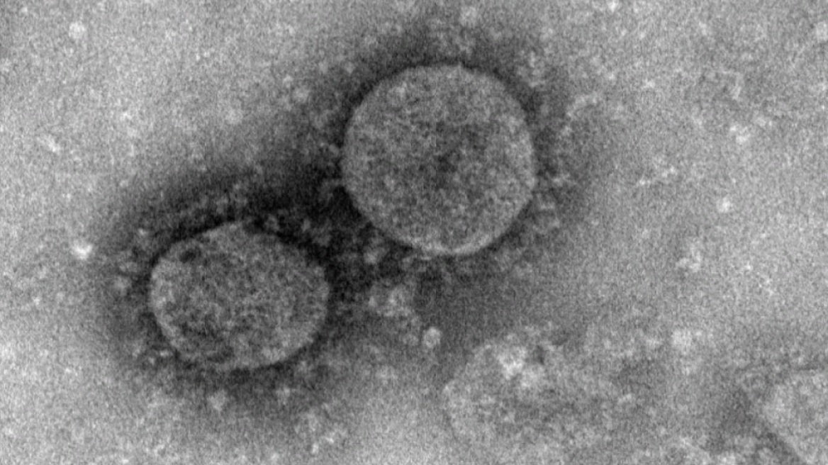 Κοροναϊός: Ερευνητές στο Χονγκ Κονγκ έχουν αναπτύξει ήδη εμβόλιο για την αντιμετώπισή του