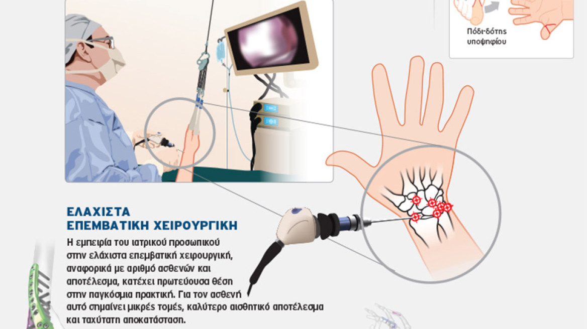 Οι πιο σύγχρονες θεραπείες για όλες τις παθήσεις των χεριών