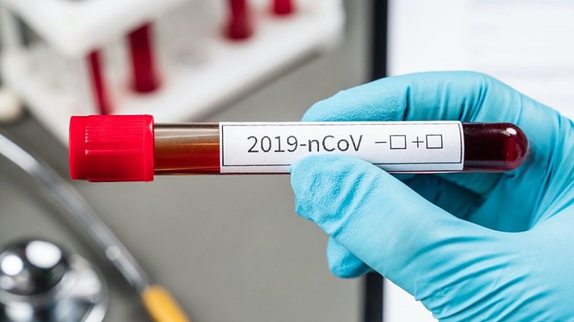 Κορωνοϊός: Νέο, ιαπωνικό τεστ υπόσχεται αποτελέσματα σε δύο ώρες