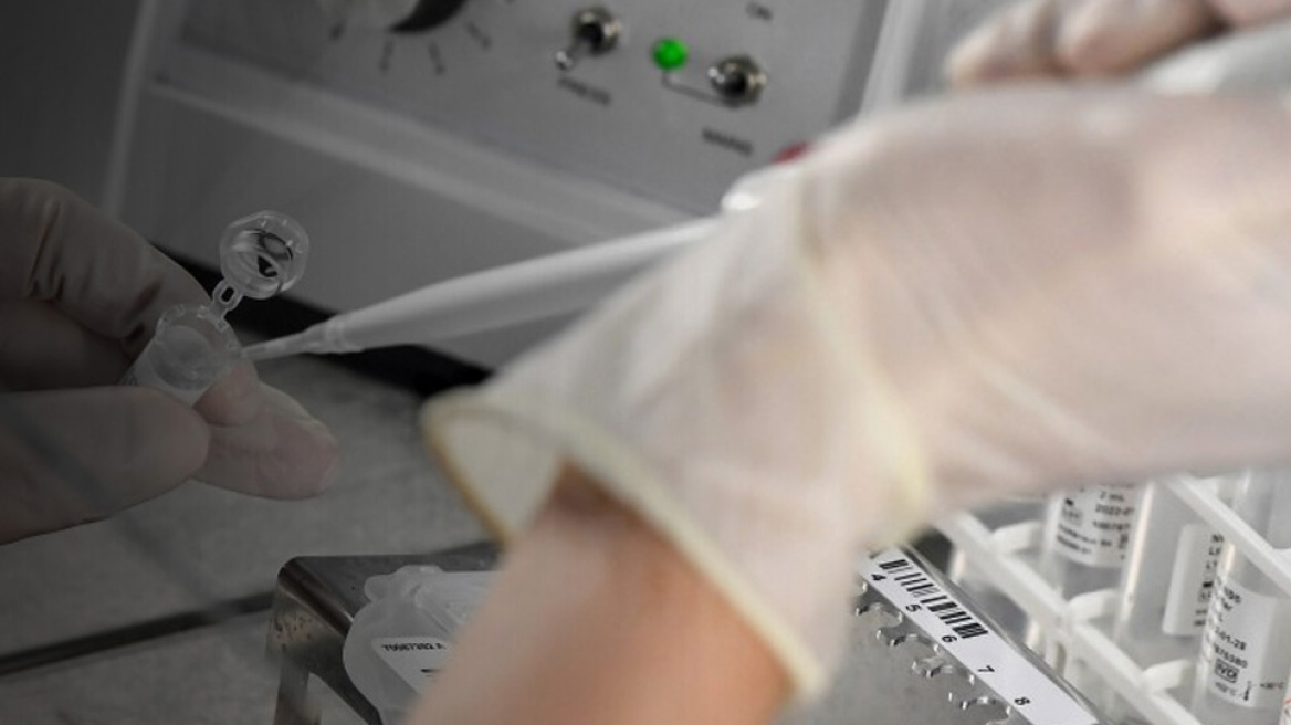 Κορωνοϊός - Υδροξυχλωροκίνη: Ο ΠΟΥ ανακοίνωσε την επανέναρξη των κλινικών δοκιμών