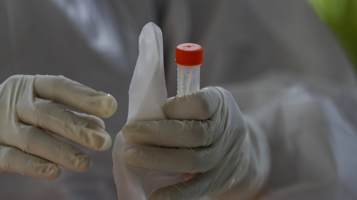 Κύπρος: 181 νέα κρούσματα ανακοίνωσε το υπουργείο Υγείας