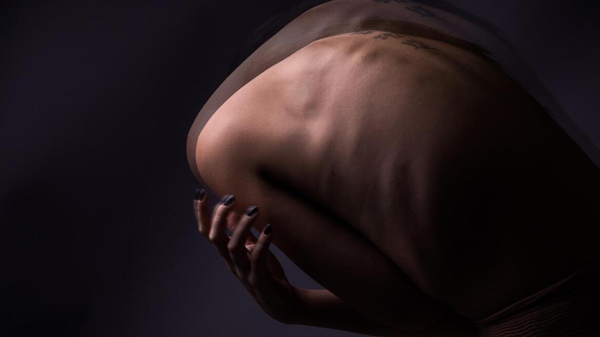 «Στεγόσαυρος»: Ένας συγκλονιστικός θεατρικός μονόλογος για τη μάχη με την νευρική ανορεξία