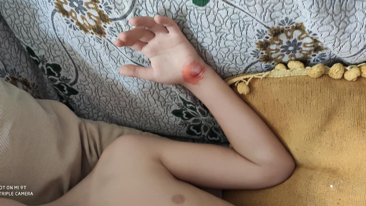 Τροχαίο στην Κεφαλονιά: Πήρα το παιδί μου σε ημιλιπόθυμη κατάσταση