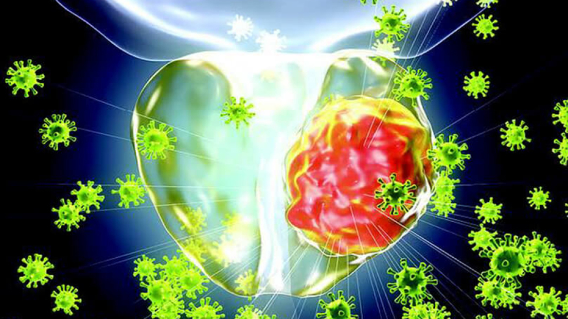 Η διάγνωση στον καρκίνο του προστάτη