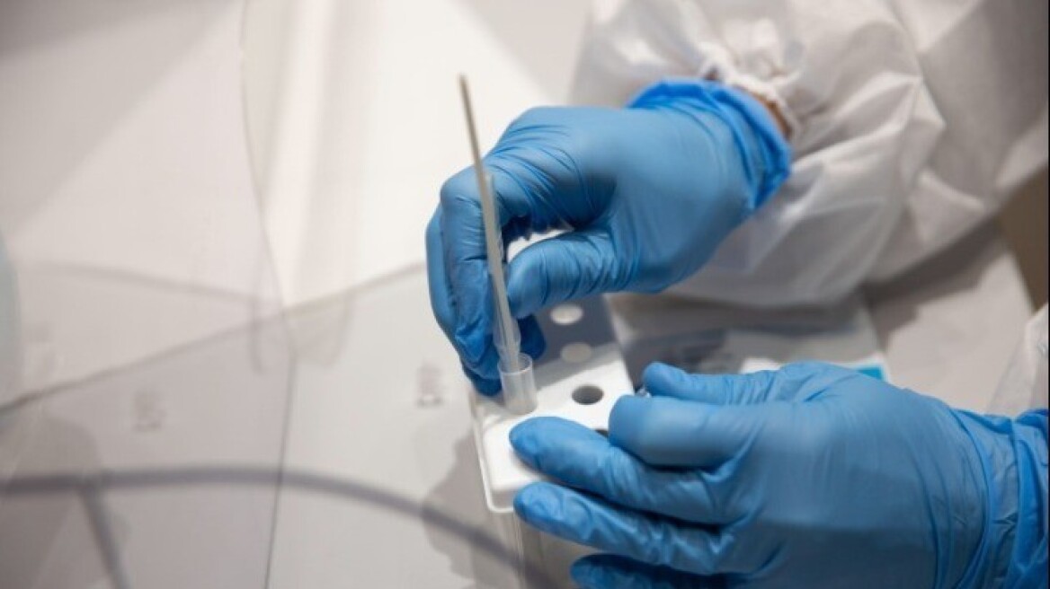 Έρευνα: Η σοβαρή Covid-19 μπορεί να γυρίσει μπούμερανγκ το ανοσοποιητικό σε βάθος χρόνου