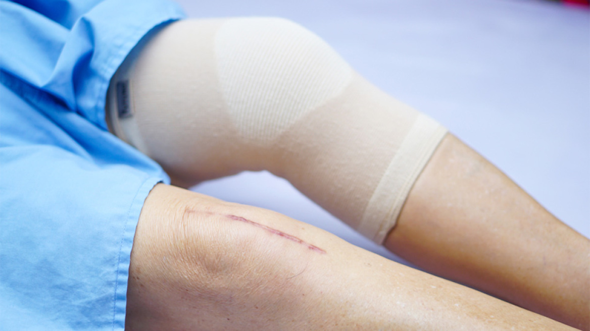 Αρθροπλαστική: Nεότερα δεδομένα και οφέλη για τον ασθενή