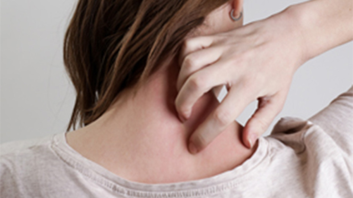 Έρπης ζωστήρας & ηλικία: Μια σχέση που «σοβαρεύει» με τα χρόνια