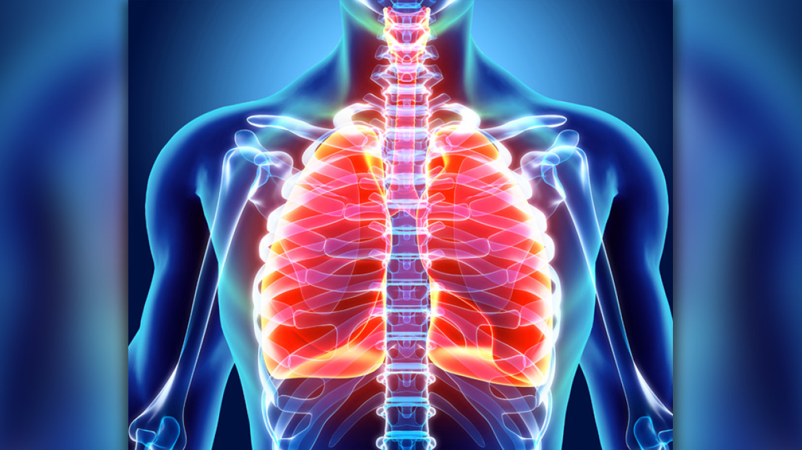 Ελάχιστα επεμβατική χειρουργική στον καρκίνο του πνεύμονα