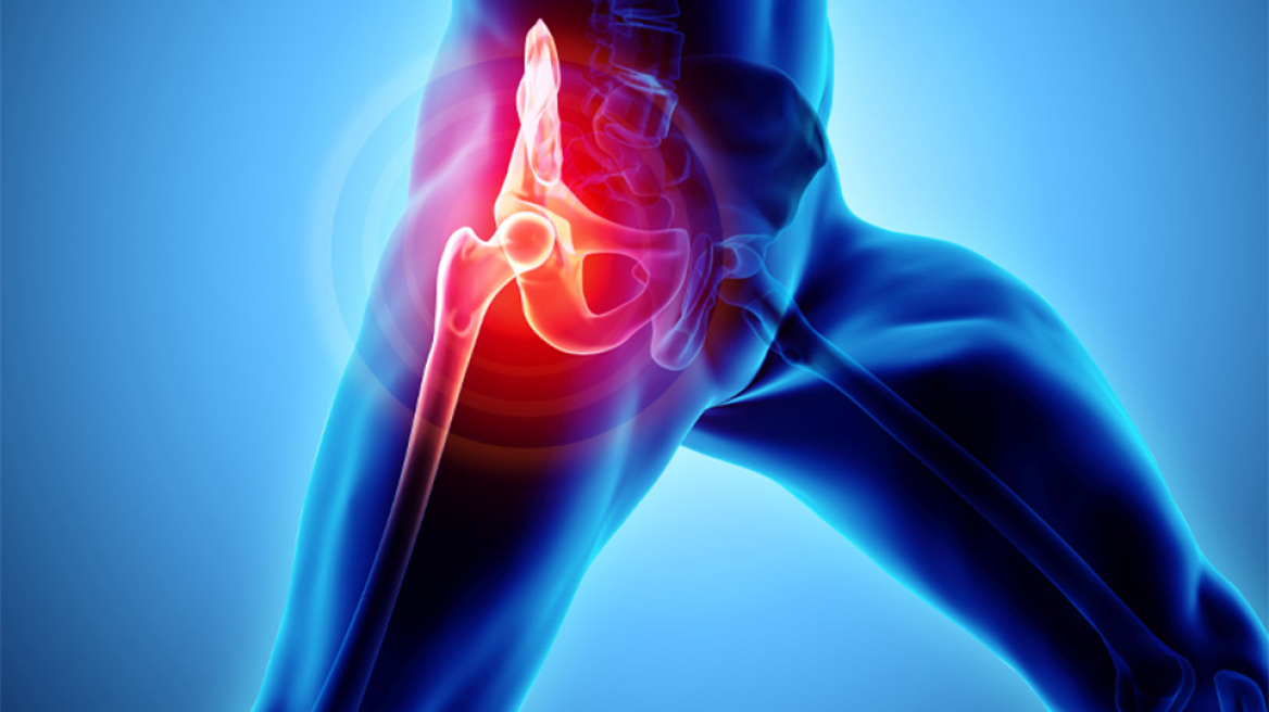 Αντιμετώπιση της οσφυοϊσχιαλγίας με laser