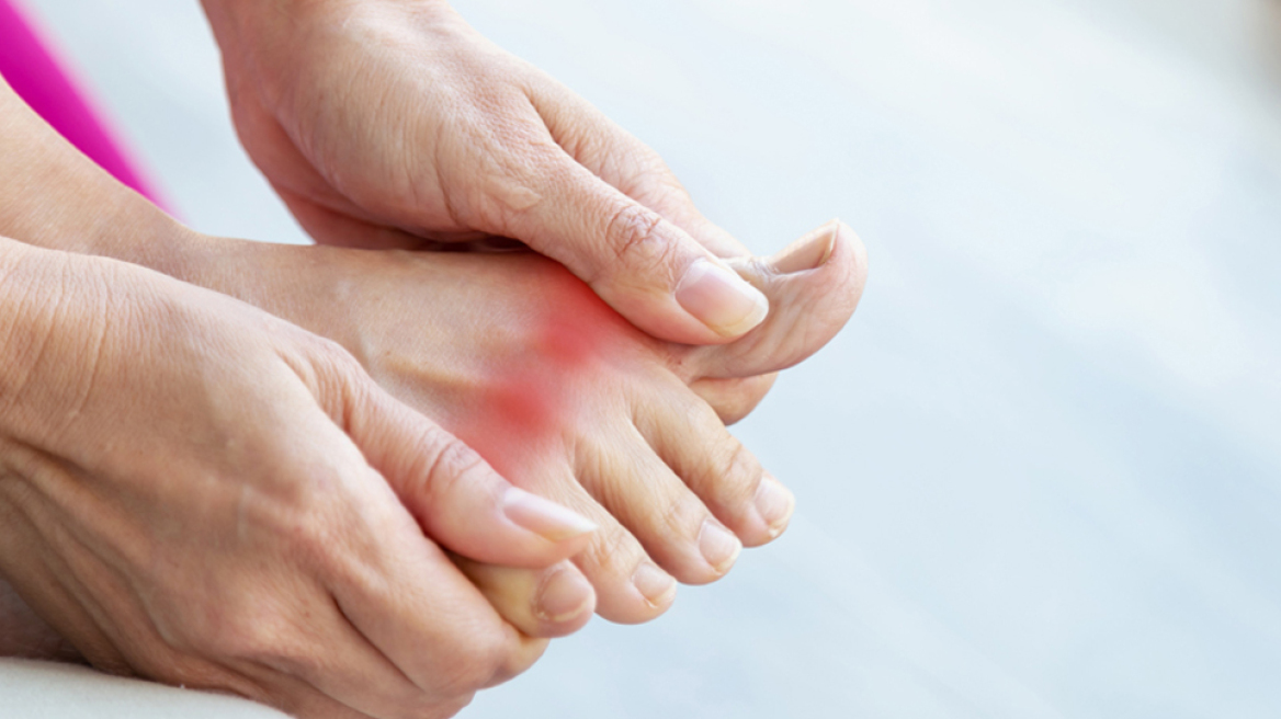 Ουρική αρθρίτιδα: Συμπτώματα, διάγνωση και θεραπεία