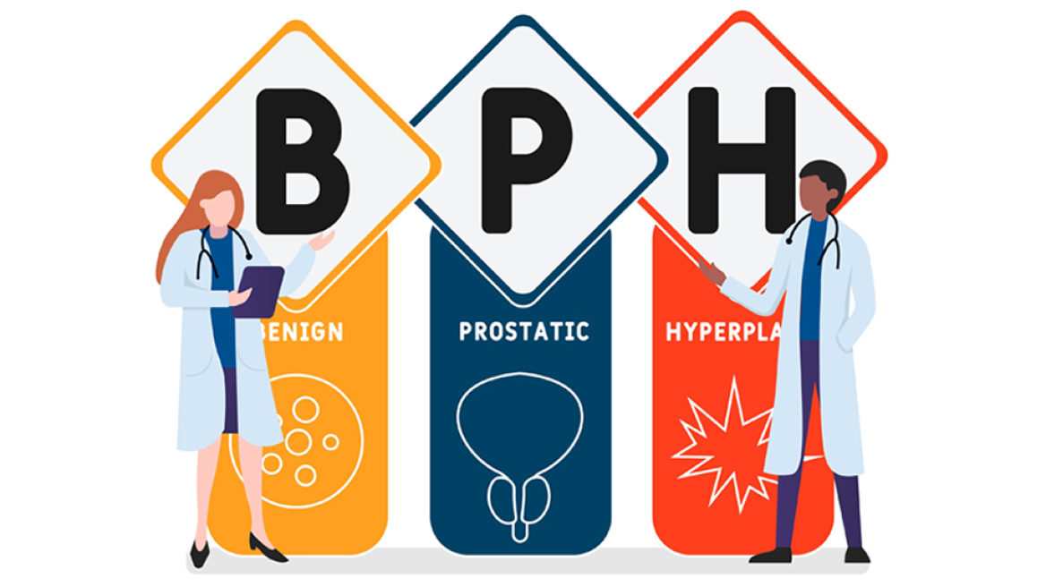 Μέθοδος Rezum: Νέα εποχή στην αντιμετώπιση της καλοήθους υπερπλασίας του προστάτη