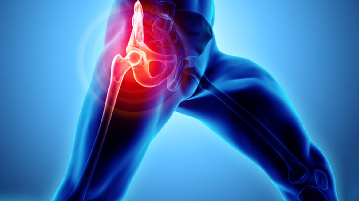 Τεχνική AMIS: Η πλέον φιλική προς τον ασθενή θεραπεία της οστεοαρθρίτιδας