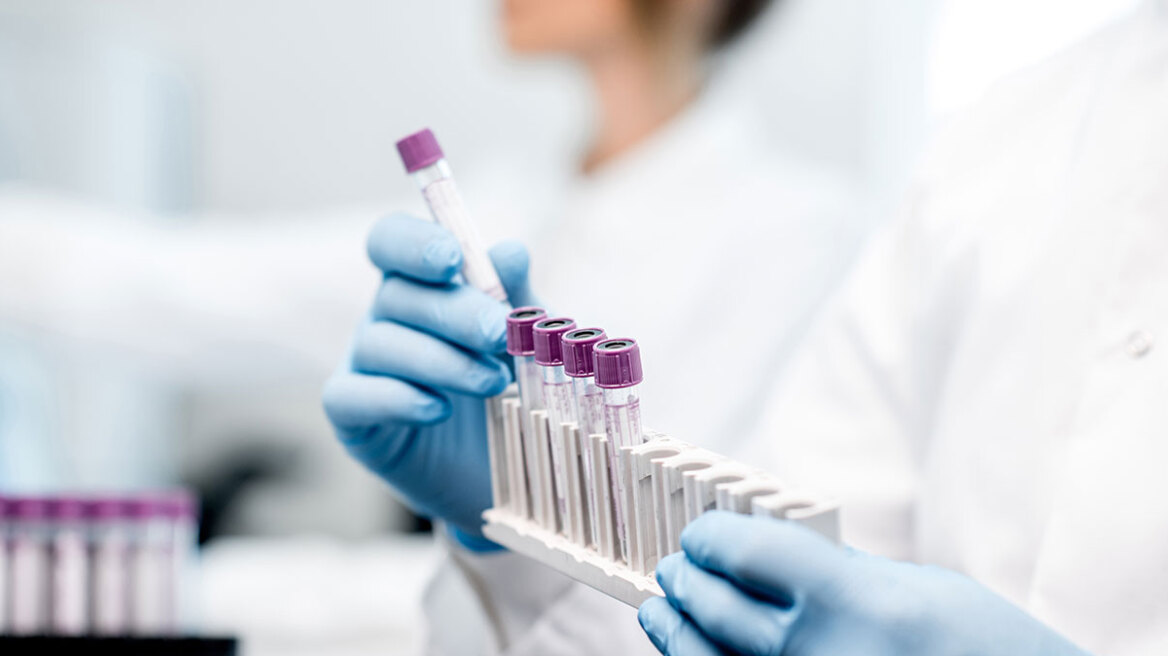 Νέο «έξυπνο» τεστ αίματος ανιχνεύει τον καρκίνο του ήπατος