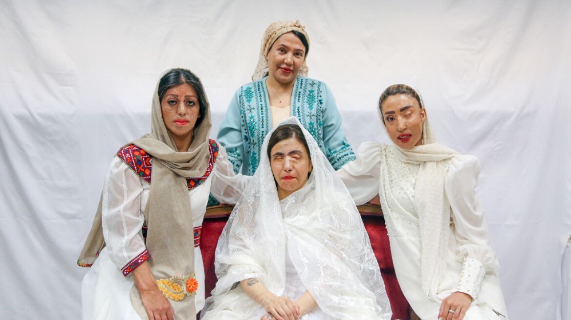 Ιρανή σχεδιάστρια μόδας επιλέγει ως μοντέλα γυναίκες που έπεσαν θύματα επιθέσεων με οξύ