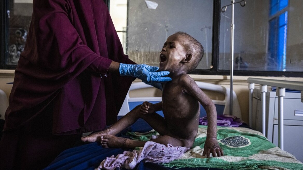 ΟΗΕ: 4,4 εκατ. άνθρωποι στη Σομαλία κινδυνεύουν να υποστούν λιμό ως τον Ιούνιο  