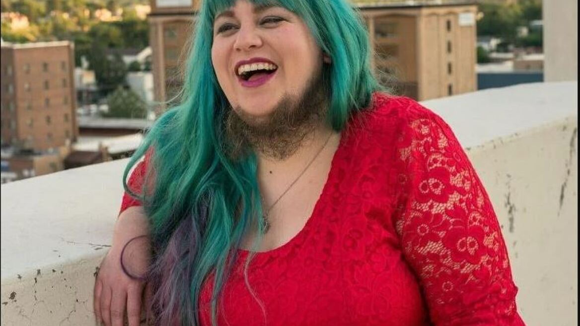 H Annalisa είναι μια γυναίκα με μούσι: Σταμάτησε να ξυρίζεται χάρη στην υποστήριξη του συζύγου της