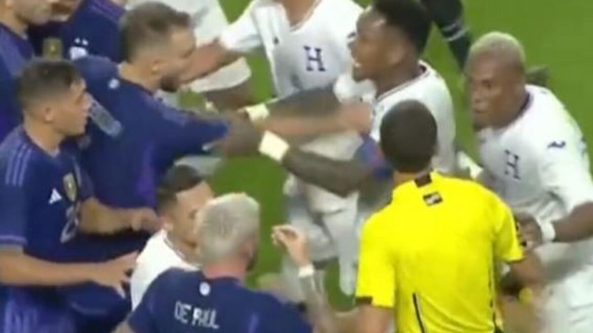  Λιονέλ Μέσι: Του έριξε αγκωνιά ο Φλόρες του Παναιτωλικού 