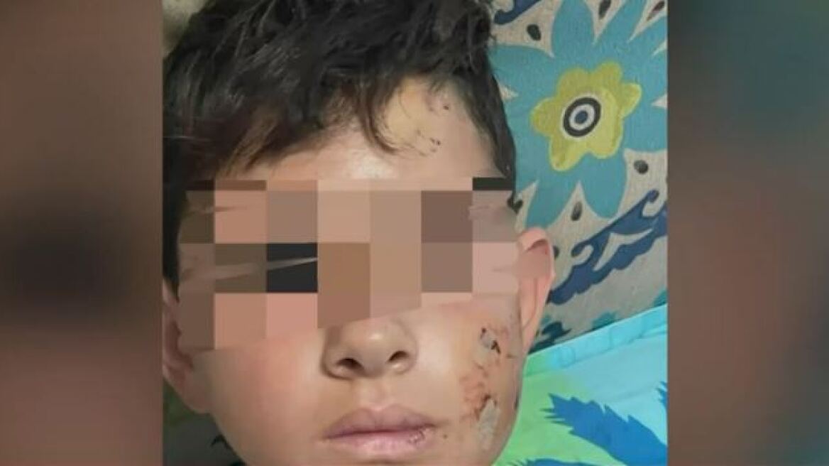 Λαγονήσι: Η συγκλονιστική μαρτυρία του ανθρώπου που έσωσε τον 13χρονο από το σκυλί - «Πετούσα πέτρες, φώναζα»