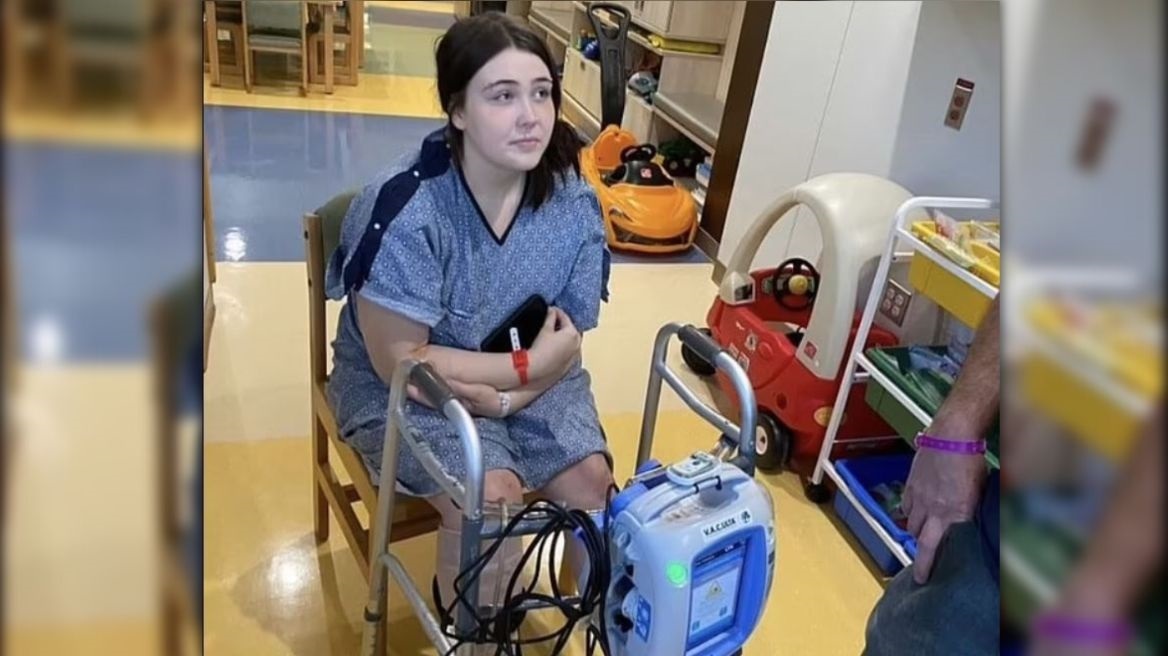 Νέα Υόρκη: Έφηβη παραλίγο να χάσει το πόδι της από επίθεση πίτμπουλ 