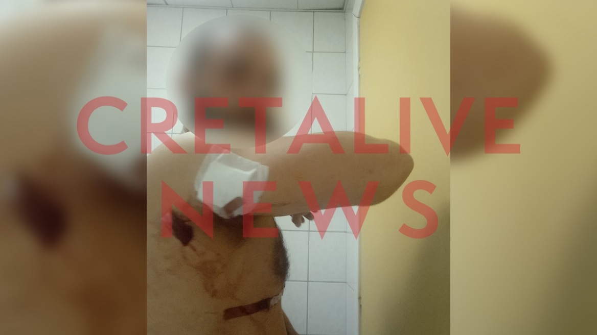 Κρήτη: Ήθελε να μου κάνει ζημιά, λέει ο 33χρονος που δέχτηκε επίθεση από τον πρώην της γυναίκας του