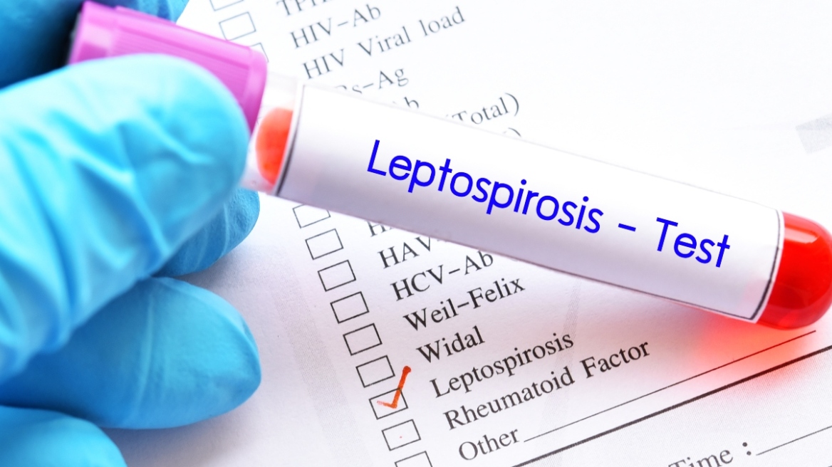 Λεπτοσπείρωση: Τι είναι η μικροβιακή λοίμωξη από την οποία πέθανε ο 57χρονος στη Ζάκυνθο