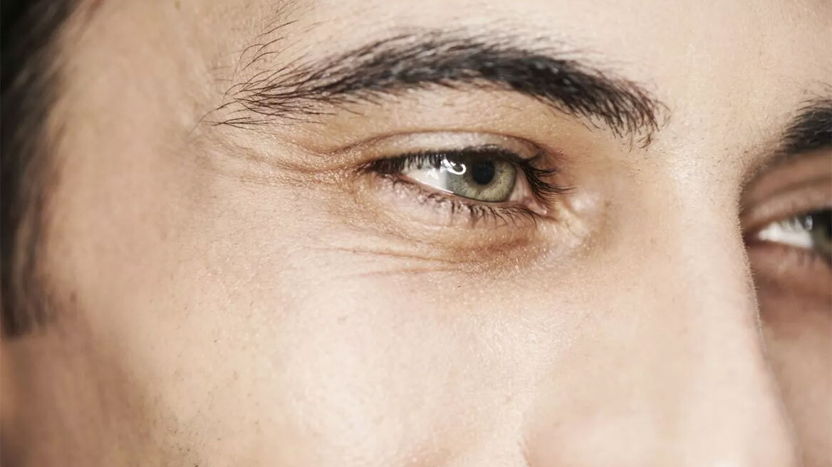 Σαγόνι, βλέφαρα, λίφτινγκ: Οι πλαστικές επεμβάσεις που κάνουν οι άνδρες σε Αθήνα και Λος Αντζελες