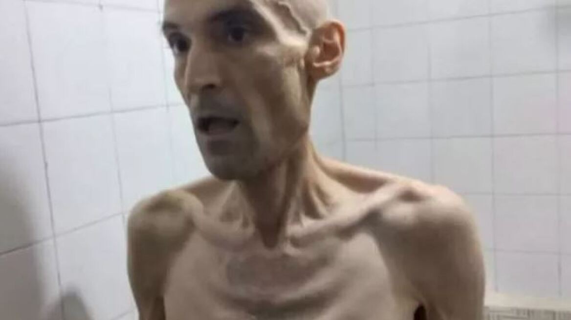 Ιράν - Εικόνες φρίκης: Αποστεωμένος φυλακισμένος απεργός πείνας 