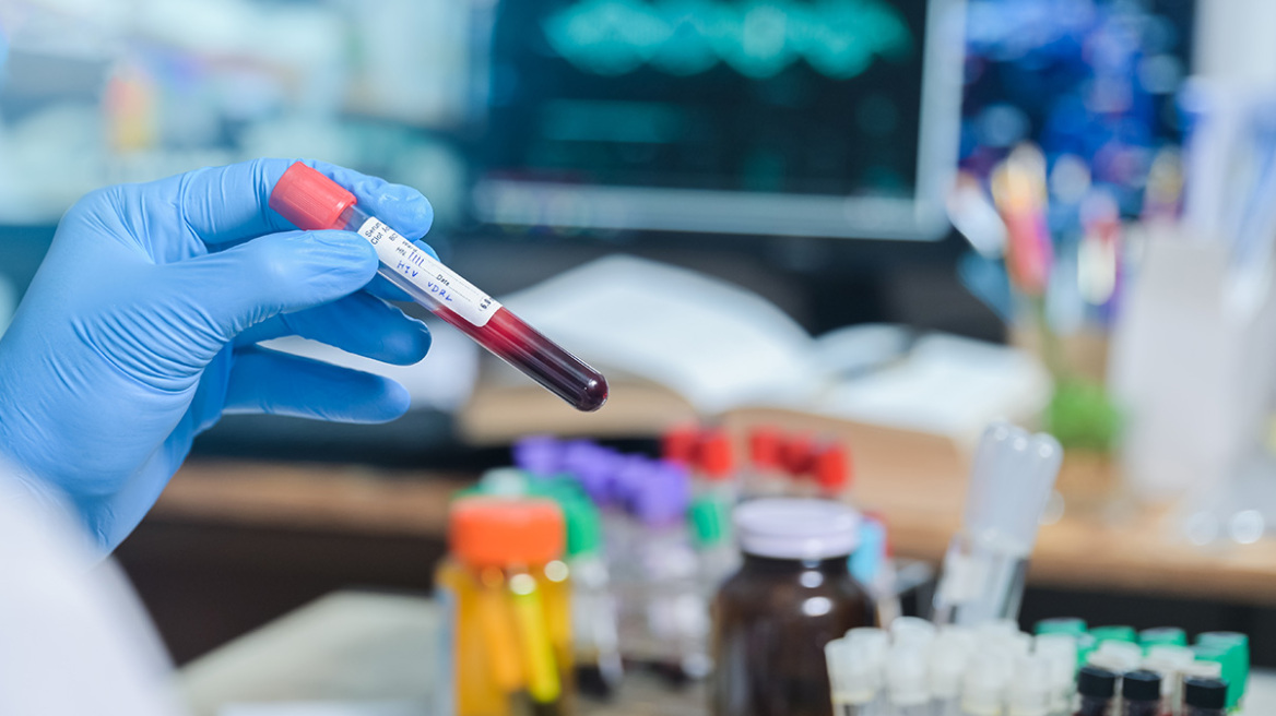 Ντίσελντορφ: 53χρονος θεραπεύτηκε πλήρως από τον HIV