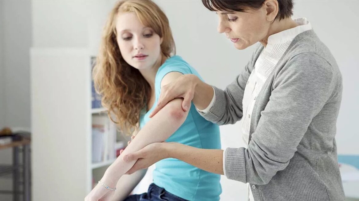 Ψωρίαση: Οκτώ μύθοι για τη νόσο που αφορά 200.000 ασθενείς στην Ελλάδα