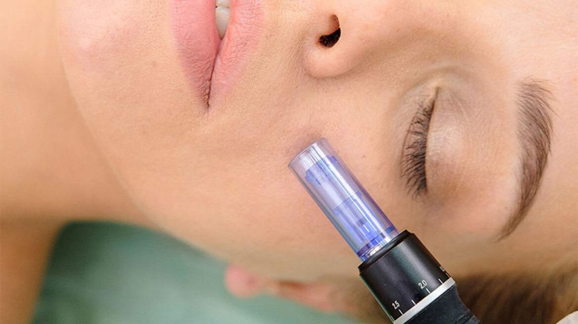 Μεσοθεραπεία: Άμεση ενυδάτωση και λάμψη της επιδερμίδας