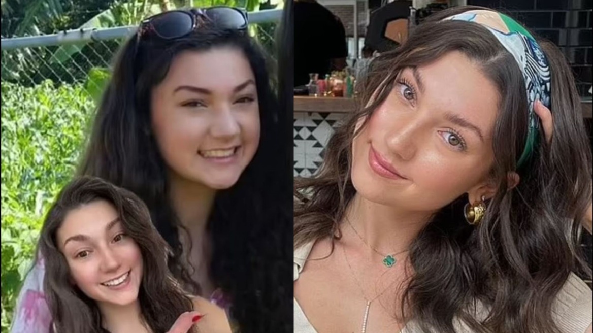 Βίντεο: Influencer αποκάλυψε πώς απέκτησε σμιλευμένο σαγόνι χωρίς αισθητική επέμβαση