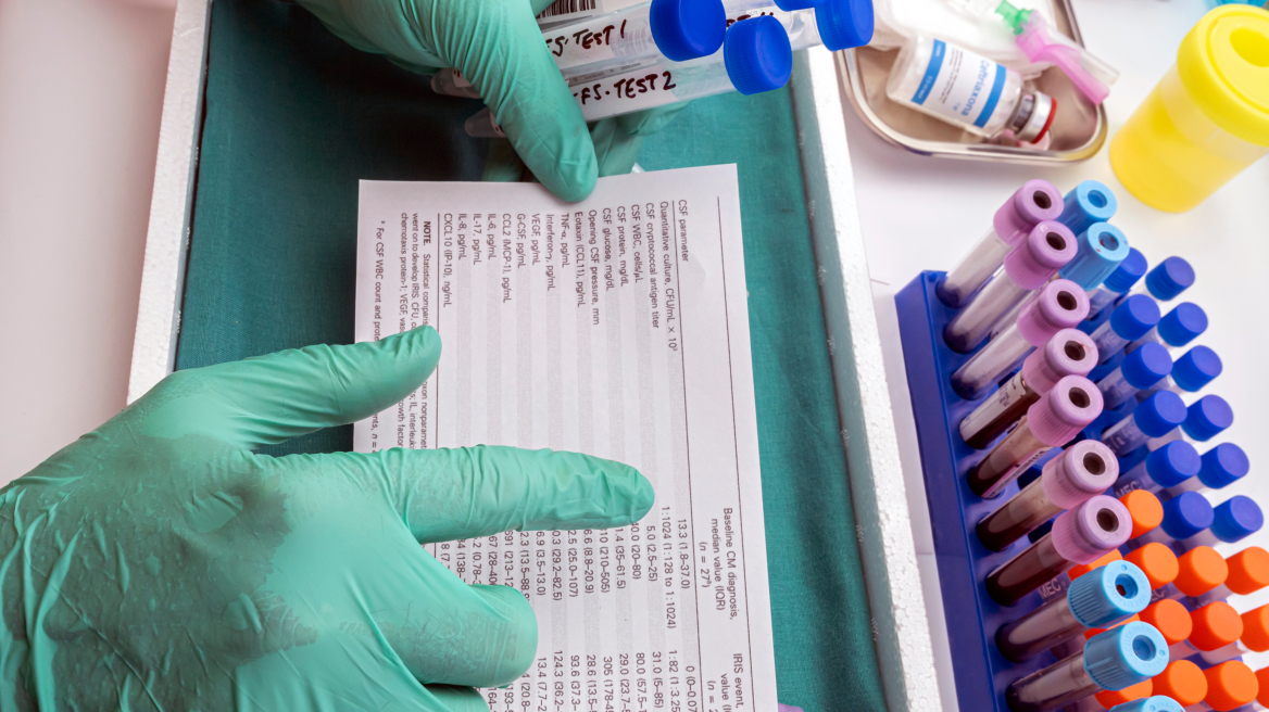 Έρευνα: Ένας στους 10 Βρετανούς πάσχει από κάποιο αυτοάνοσο νόσημα