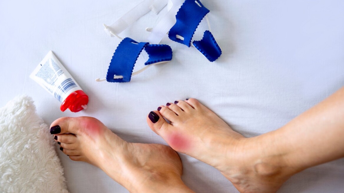 Κότσι: Μπορεί να ξαναδημιουργηθεί; Ο ειδικός απαντά