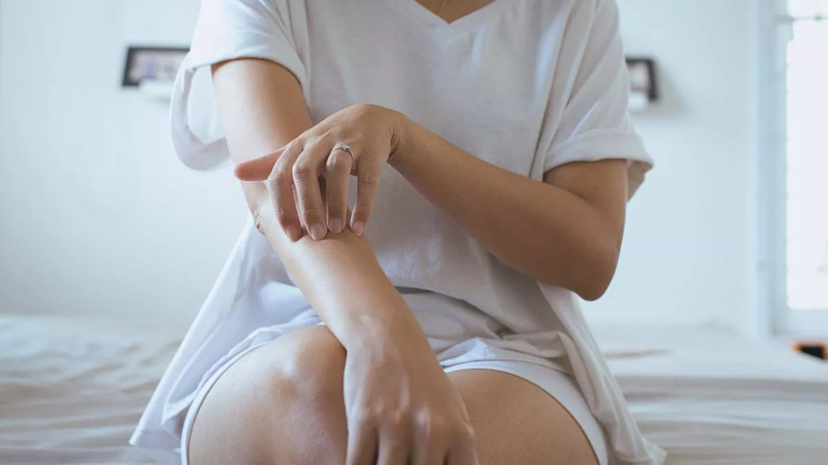 Η επικίνδυνη σιωπηρή νόσος που αφορά πάνω από το 54% των ασθενών με ψωρίαση